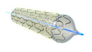 Coronary stent / stainless steel / with applicator MGuard InspireMD