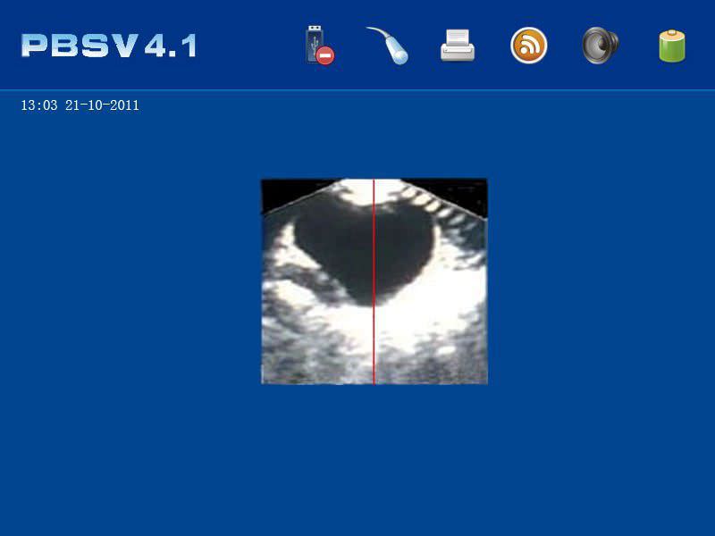 Hand-held ultrasound bladder scanner PBS V3.1 Mianyang Meike Electronic Equipment Co., Ltd
