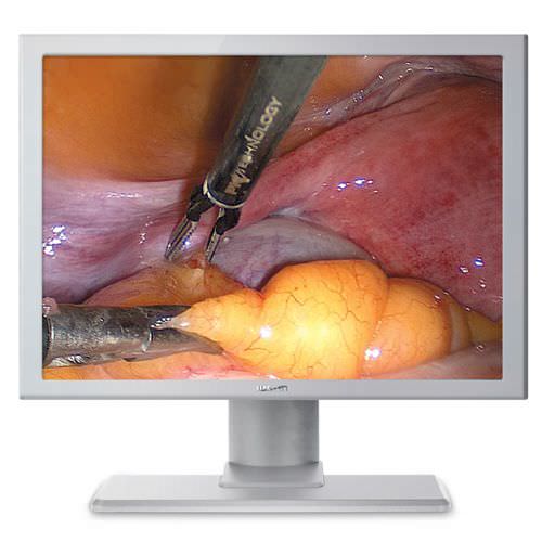 High-definition display / endoscopy / surgical 17" | JUSHA-ES17 Nanjing Jusha Display Technology Co.,Ltd