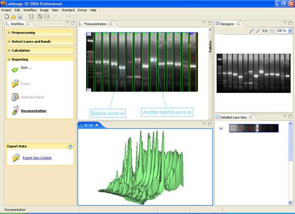 Analysis software / laboratory Labimage 1D Professional BIOTEC-FISCHER
