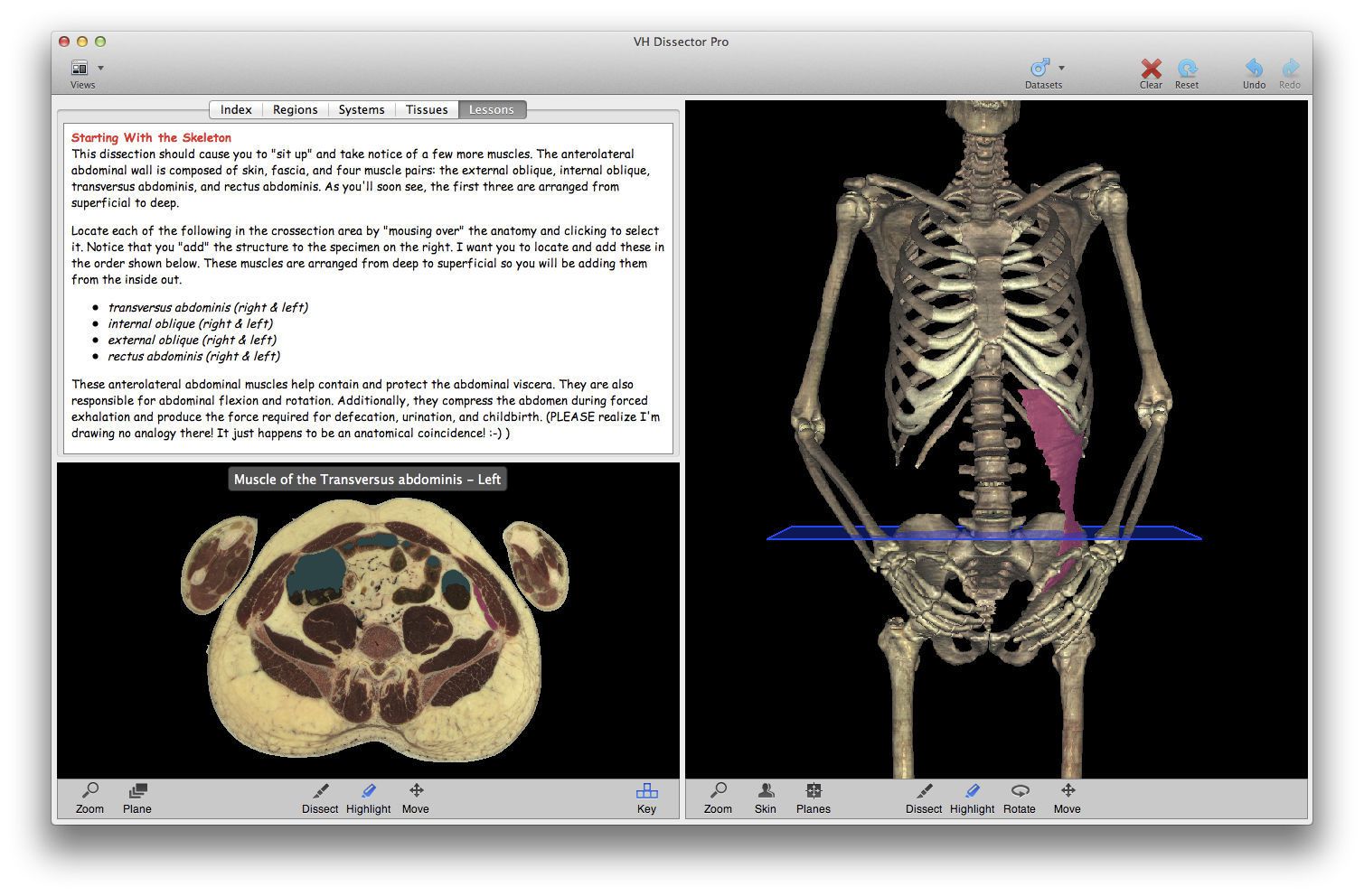 Training software / anatomy VH Dissector for Undergraduate Education TolTech
