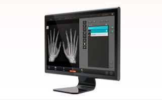 Reporting software / analysis / medical imaging / medical QUANTORMED+ 3Disc Imaging