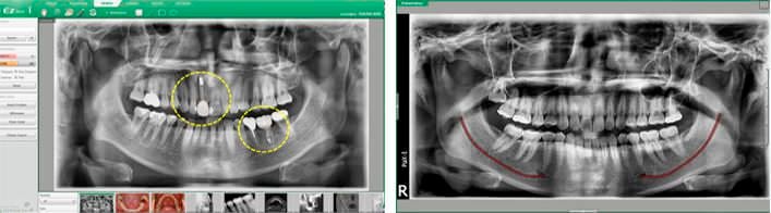 Dental imaging software / medical EzDent-i VATECH