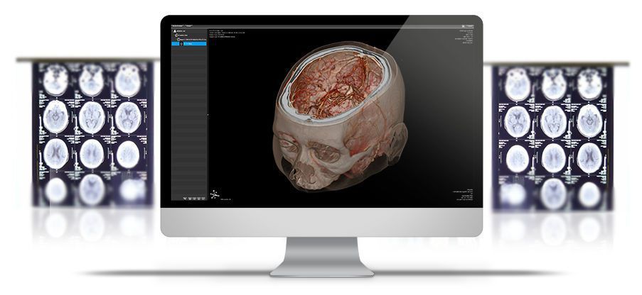 Diagnostic software / 3D viewing / medical / medical imaging ResolutionMD™ Calgary Scientific