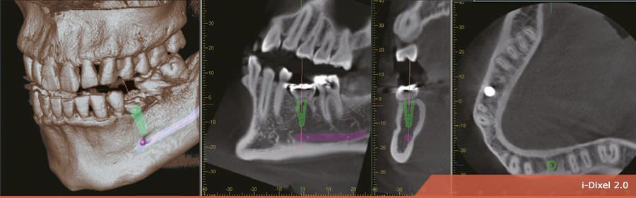 Dental imaging software / medical i-Dixel 2.0 Morita