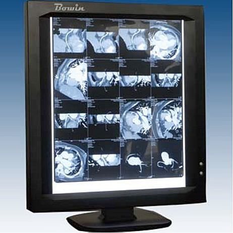 1-section X-ray film viewer LEDVIEW-360 Bowin Medical