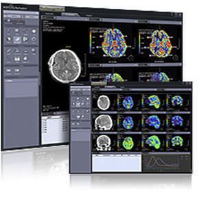 Viewing software / analysis / medical Xelis-Perfusion Infinitt Healthcare Co., Ltd.