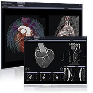 3D viewing software / diagnostic / medical / cardiology Xelis Infinitt Healthcare Co., Ltd.