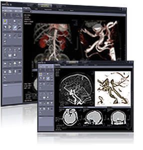 Diagnostic software / 3D viewing / medical imaging / for hospitals Xelis 3D Infinitt Healthcare Co., Ltd.