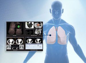 3D viewing software / diagnostic / for endoscopy / medical Xelis Lung Infinitt Healthcare Co., Ltd.