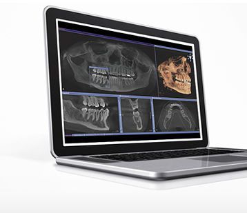 Diagnostic software / planning / 3D viewing / for dental imaging GALAXIS SIRONA France