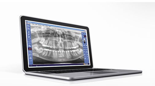 Diagnostic software / analysis / image capture / for dental imaging SIDEXIS XG SIRONA France