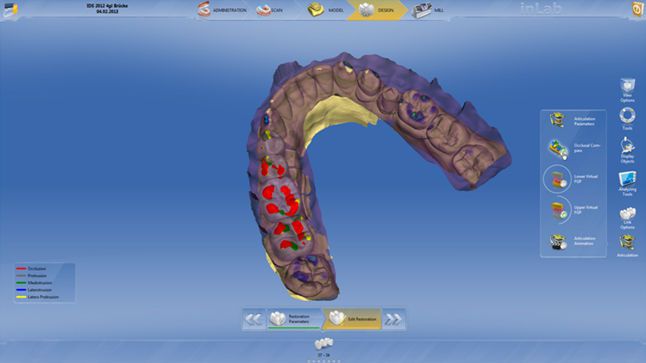 CAD software / CAM / for dental prosthesis design / dental laboratory inLab 4.2 SIRONA France