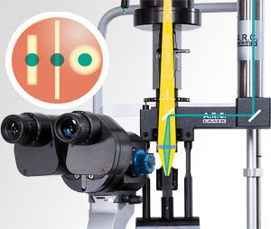 Ophthalmic laser / for trabeculoplasty / solid-state / tabletop SLT TRABECULAS A.R.C. Laser