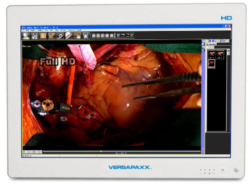 Diagnostic video recorder / with touchscreen / high-definition 22" | VersaPaxx VP222-DD Ampronix
