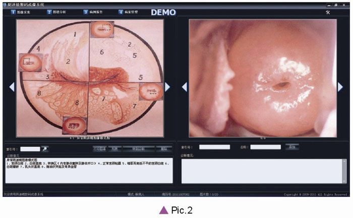 Video colposcope / mobile / with video monitor AC-4000 series Alltion (Wuzhou)