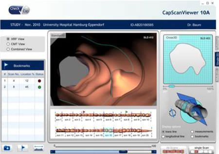 3D viewing software / navigation / endoscopy / medical CapScanViewer Check-cap