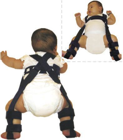 Hip dysplasia orthosis (orthopedic immobilization) / legs abduction / pediatric 5010 Arden Medikal