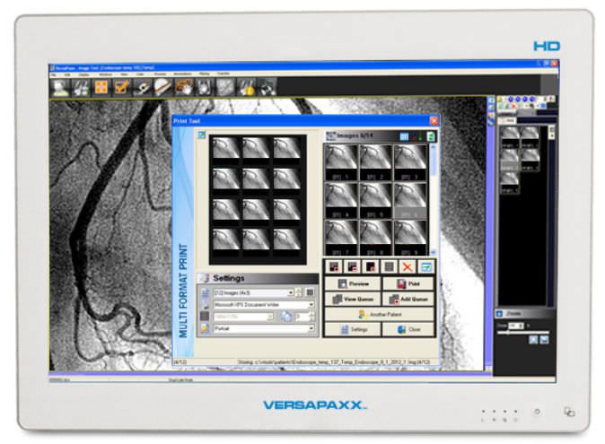 Diagnostic video recorder / with touchscreen / high-definition 22" | VersaPaxx VP222-VV Ampronix
