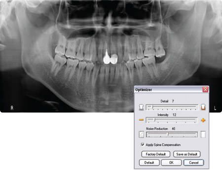 Diagnostic software / for dental imaging VIXWIN™ PLATINUM Gendex Dental Systems