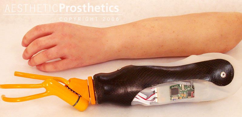 Promoting Management and Leadership -   Hand prosthesis  (upper extremity) / body-powered / hook clamp / adult Aesthetic Prosthetics