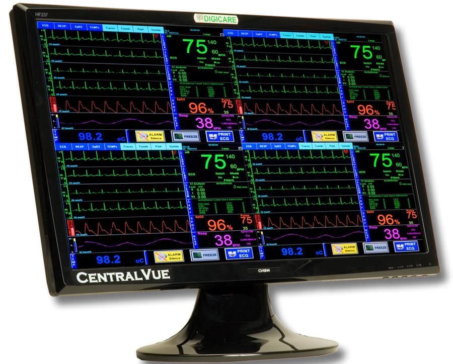 Veterinary central monitoring station CentralVue™ Digicare Biomedical Technology