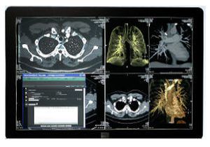 Radiology information system RIS SYNAPSE® FUJIFILM Europe