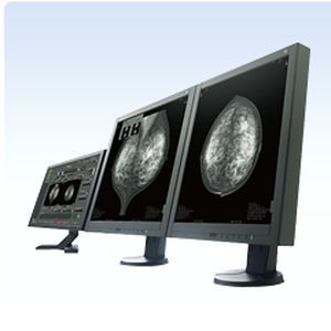 Medical computer workstation / for mammography AMULET Bellus FUJIFILM Europe