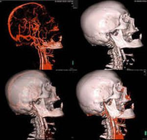 Viewing software / diagnostic / medical / medical imaging SYNAPSE 3D FUJIFILM Europe