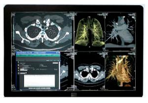 Archiving transmission system SYNAPSE® FUJIFILM Europe