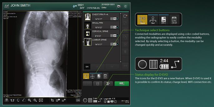 Anatomical imaging computer workstation / radiography / medical CONSOLE ADVANCE FUJIFILM Europe