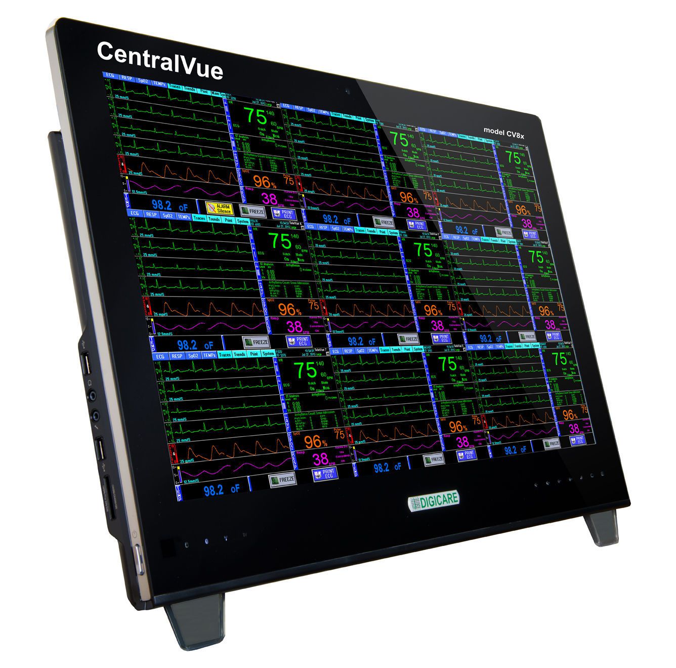 Health Management and Leadership Portal | Veterinary central monitoring  station 23? | CentralVue™ Digicare Animal Health 