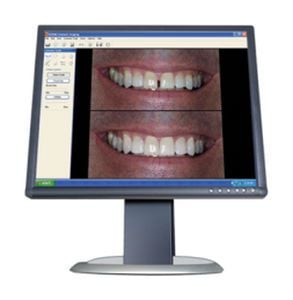 Software / simulation / viewing / dental / dentist office Carestream Dental