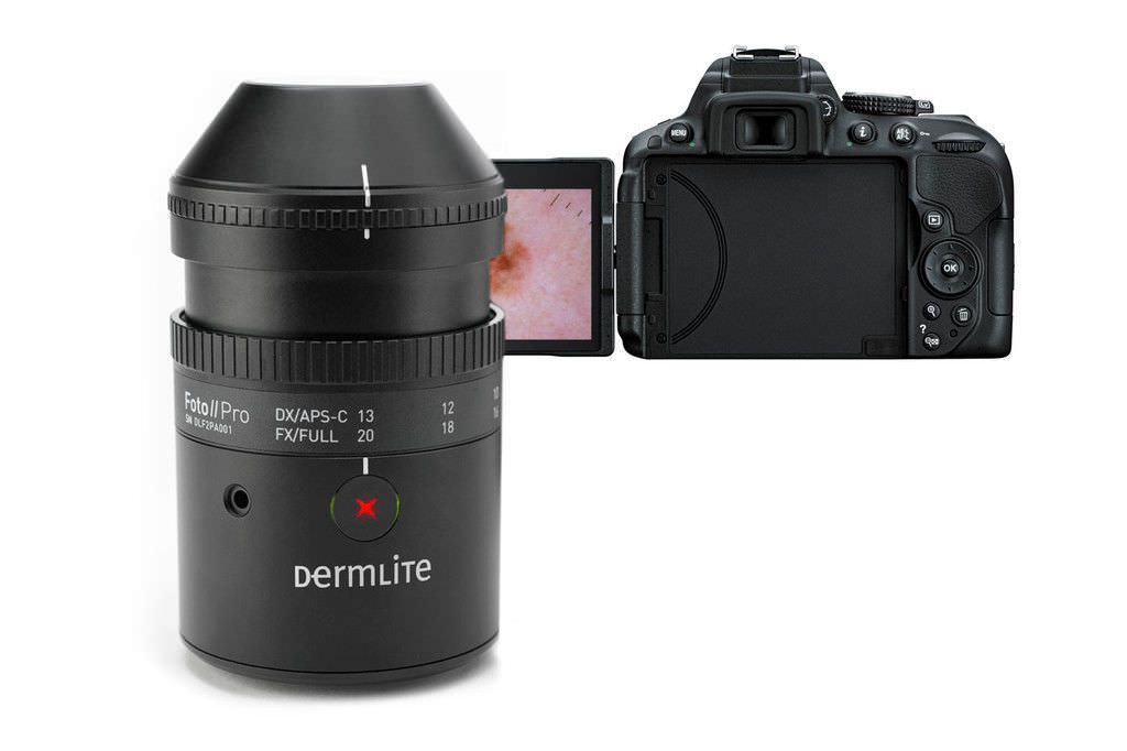 Video dermatoscope with camera adapter DermLite Foto II Pro Plus Dermlite