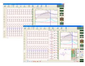 Cardiac stress test equipment Easy ECG Stress Ebneuro