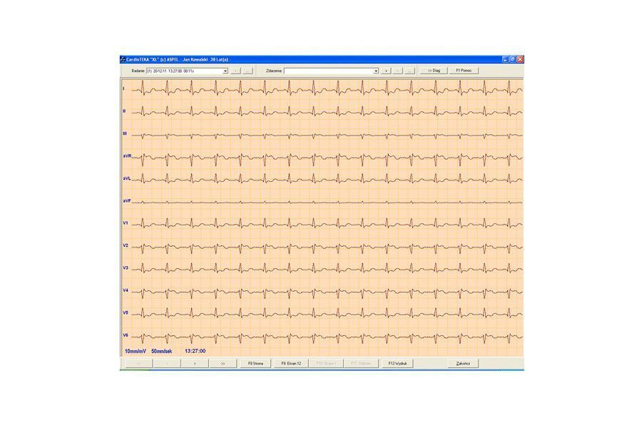 Medical software / electrocardiography CardioTEKA ASPEL
