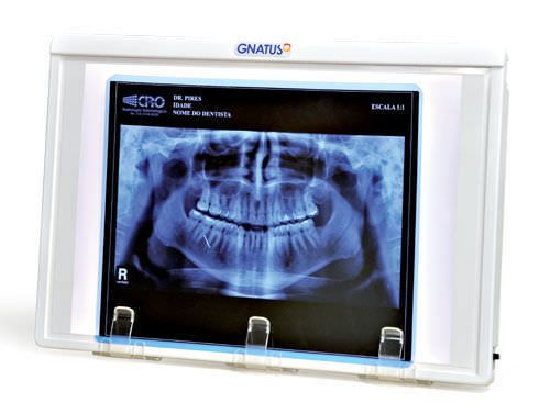 White light X-ray film viewer / 1-section / dental / with switch Gnatus
