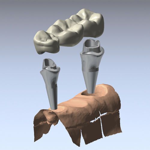 CAD software / CAM / for dental prosthesis design / medical DentCAD Delcam Plc