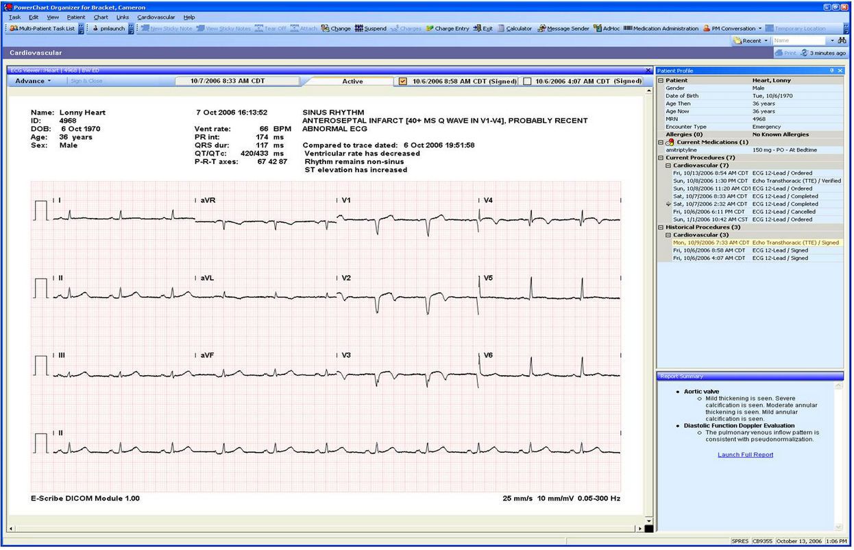 Medical software / ECG PowerChart ECG™ Cerner