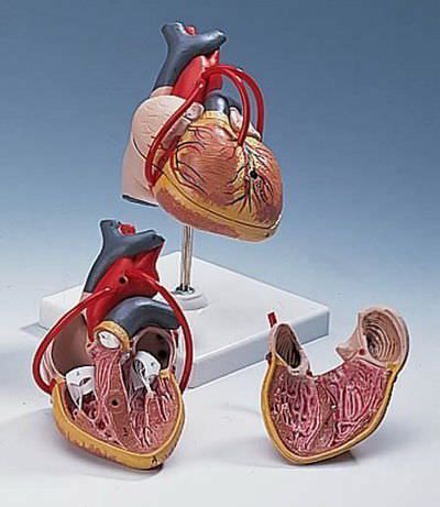 Heart anatomical model / with vascular bypass G 05 RÜDIGER - ANATOMIE