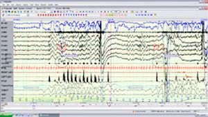 Mobile electroencephalograph / 256-channel Neurofax EEG-1200 Nihon Kohden Europe