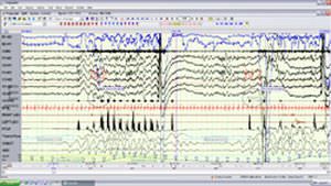 Mobile electroencephalograph / 256-channel Neurofax EEG-1200 Nihon Kohden Europe