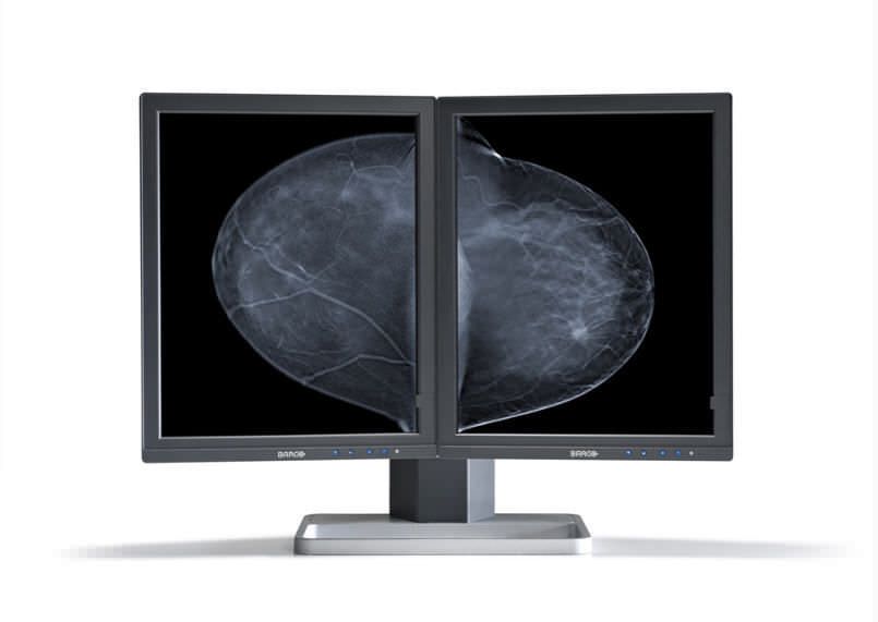 LCD display / monochrome / medical / diagnostic 5 MP | Mammo Tomosynthesis MDMG-5221 Barco