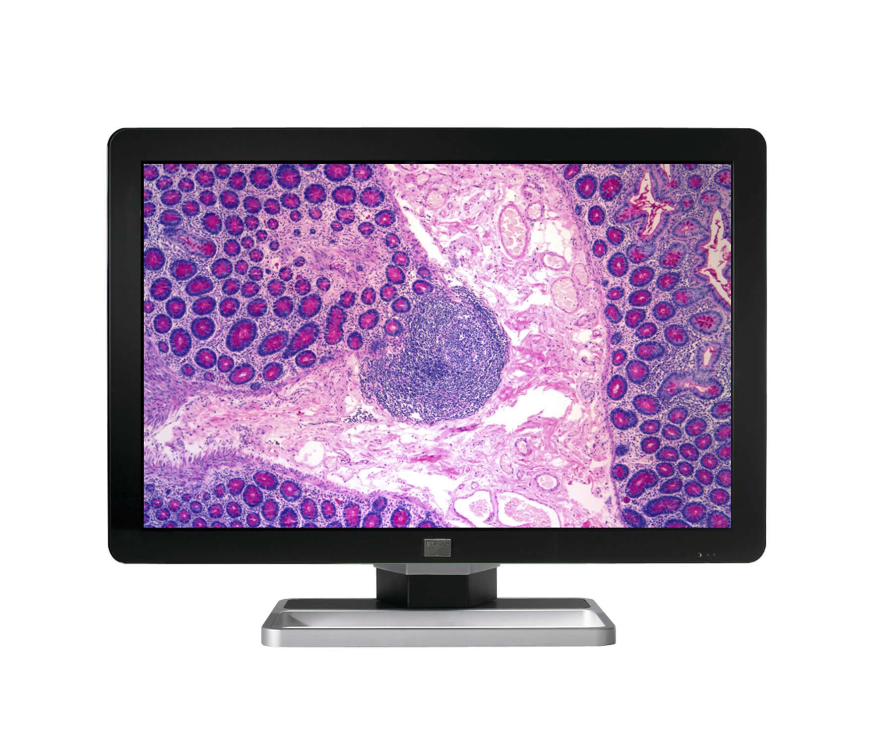 High-definition display / LCD / medical 4 MP | Coronis Fusion MDCC-4130 Barco