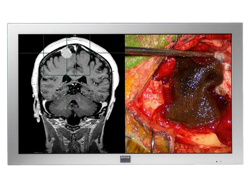 LED display / high-definition / surgical 2 MP | MDSC-2242 Barco