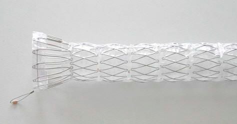 Esophageal stent / stainless steel BOUBELLA-E ELLA-CS Esophageal stent / stainless steel BOUBELLA-E ELLA-CS