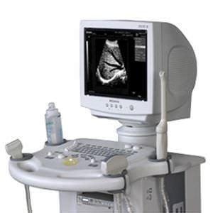Ultrasound system / on platform / for multipurpose ultrasound imaging DUS 8 EDAN INSTRUMENTS