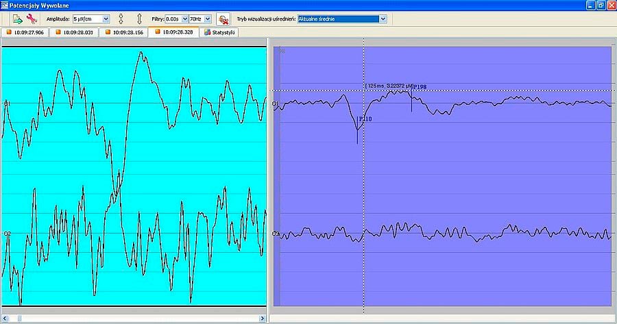 EEG software / medical EEG DigiTrack VEP ELMIKO Medical Equipment