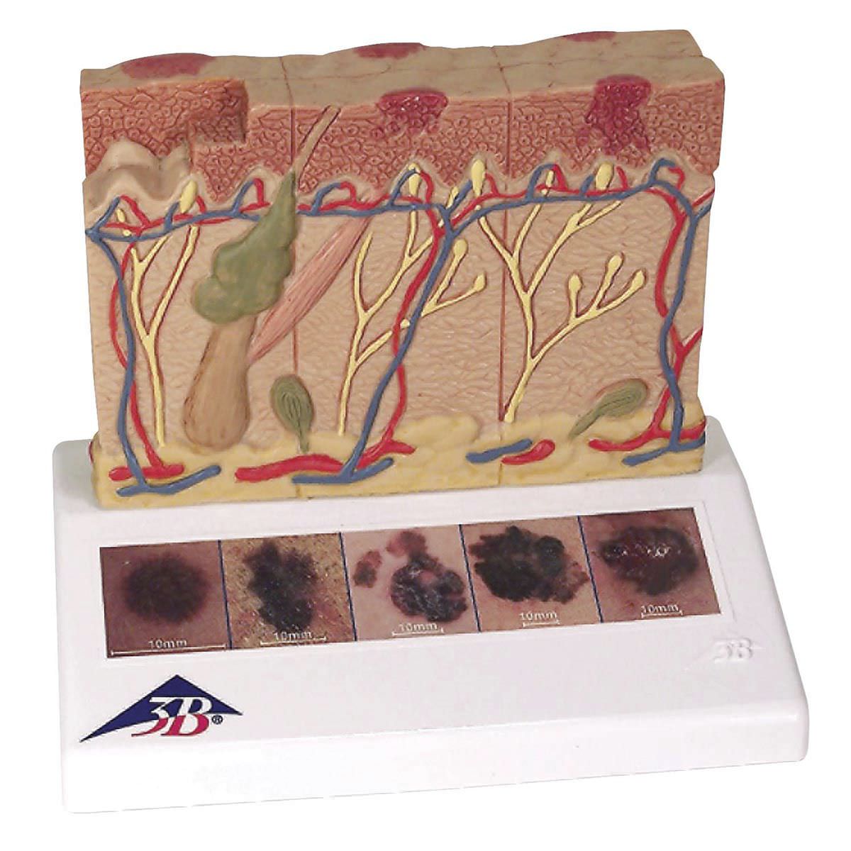 Skin pathology anatomical model J15 3B Scientific