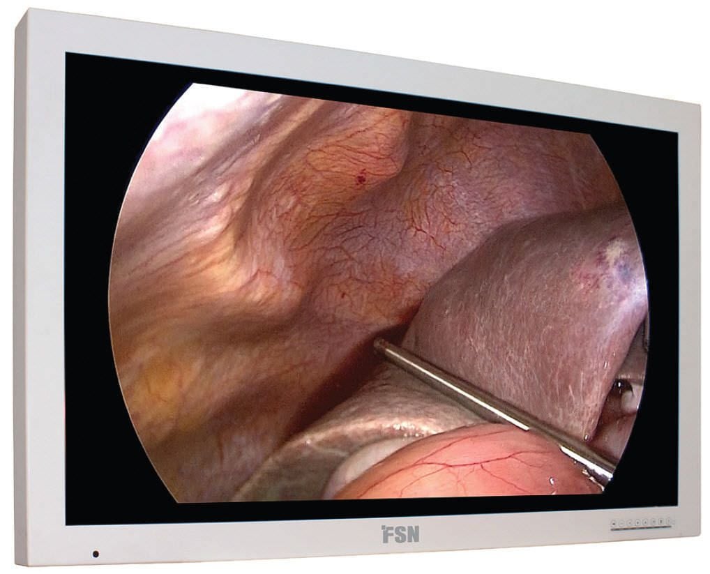 High-definition display / LCD / endoscopy / surgical FS-L4202D FSN Medical Technologies